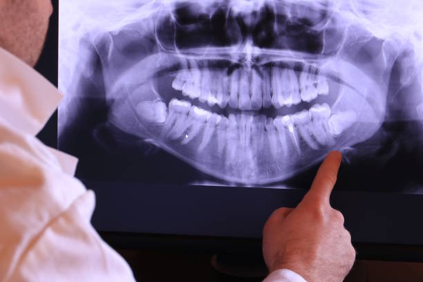 Best Emergency Dentist Open Today  in Tuscumbia, AL