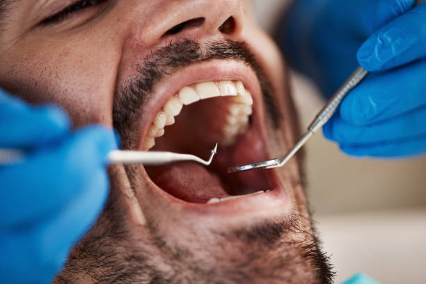 Best Chipped Tooth Repair Near Me  in Tuscumbia, AL
