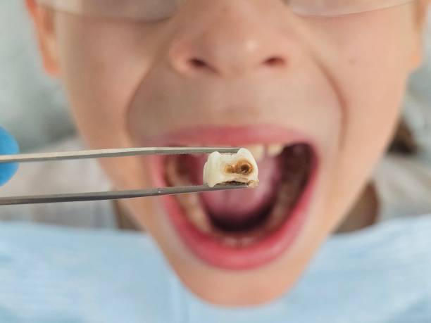 Best Tooth Infection Emergency Dentist  in Tuscumbia, AL